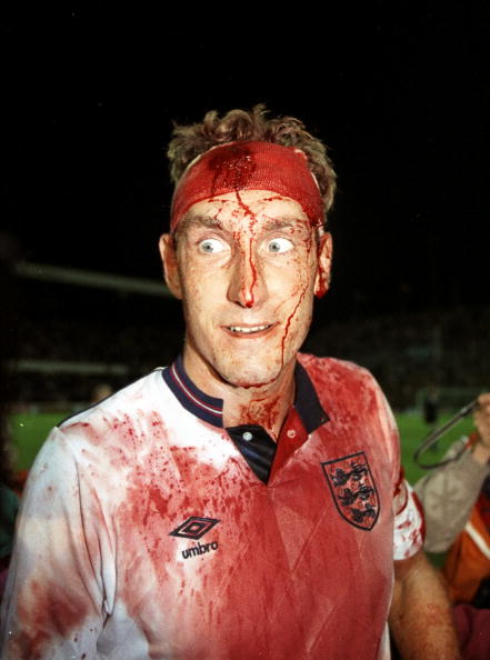 Terry Butcher gave blood for England to help them qualify for the 1990 World Cup finals. But this Three Lions icon was not born in England