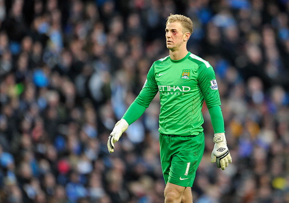 Bloodied but not beaten...Joe Hart has fought back to claim his place after being dropped ©Getty Images