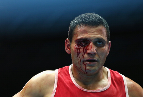 Bloodied but not beaten - Samir El-mais of Canada won his quarter-final bout againt Warren Baister of England in the men's 91kg division ©Getty Images